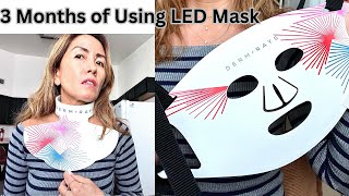 DermRays Light Therapy Mask Review 3 Months Later BIG Results [upl. by Lyj]