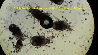 Terrible Mites Under Microscope Live Mites Acarus siro X 100 ENGLISH Story [upl. by Atrebor]