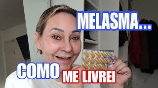 COMO ACABEI COM O MELASMA EM CASA PASSO A PASSO [upl. by Enneles]