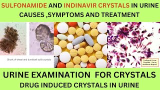 SULFONAMIDE AND INDINAVIR CRYSTALS IN URINECAUSES SYMPTOMS AND TREATMENT OF SULFONAMIDE CRYSTALS [upl. by Gnirps831]