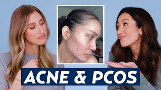 Hormonal Acne amp Polycystic Ovary Syndrome PCOS Skincare Routine for Lala  DERMATOLOGIST REACTS [upl. by Ordnazil]