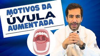 Úvula sininho campainha da garganta está inchada o que pode ser [upl. by Jueta110]