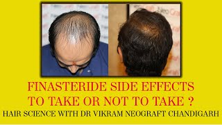 FINASTERIDE SIDE EFFECTSGUIDE HOW TO USEFINASTERIDE RESULTS [upl. by Anivol]