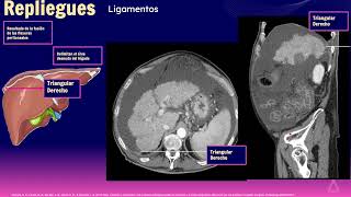 2 Cavidad peritoneal mesenterio y pared abdominal [upl. by Betsy813]