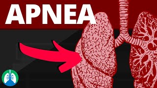 Apnea Medical Definition  Quick Explainer Video [upl. by Ahsinev566]