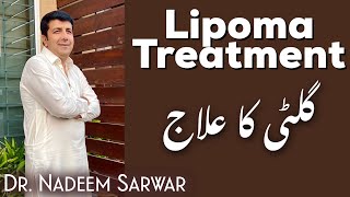 Lipoma Treatment Lipoma Ka ilaaj  Homeopathic by H Dr M Nadeem Sarwar ENG subs [upl. by Eleynad386]