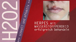 Wasserstoffperoxid gegen Herpes720p [upl. by Eyahsal]