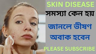 skin disease problem with solution ll diseases skin health [upl. by Anifur658]