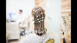 The ABCs of EEGs An Evolving Tool for Epilepsy Diagnosis [upl. by Leo]