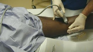 USGuided Tibial Nerve Block FULL VIDEO LINK BELOW [upl. by Melisandra]