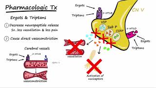 Migraines  Pathophysiology amp Treatment Described Concisely [upl. by Durst]