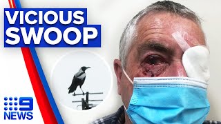 Man undergoes surgery after vicious magpie attack  9 News Australia [upl. by Ocimad]