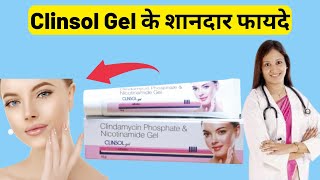 Clinsol gel Cream Review in hindi  Clinsol cream [upl. by Toland]