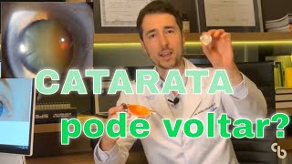 Catarata pode voltar O que é catarata O que é capsulotomia com YAG laser [upl. by Carmina]