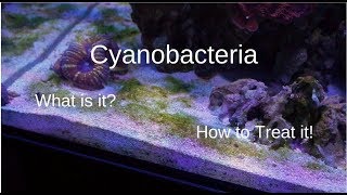 Cyanobacteria  What You Need To Know [upl. by Harihat796]