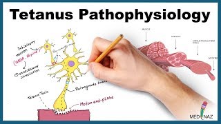 Tetanus Pathophysiology Mechanism of Action [upl. by Vod]