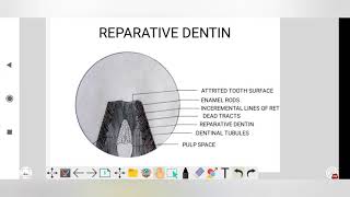 histology of reparative dentin histology lecture dental histology dentin [upl. by Leiuqese151]