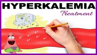 Hyperkalemia with ECG changes Treatment  Mnemonic Series 15 [upl. by Mahau240]