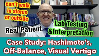 Case Study 53 y Woman with Hashimotos Off Balance amp Visual Vertigo [upl. by Ferrick176]