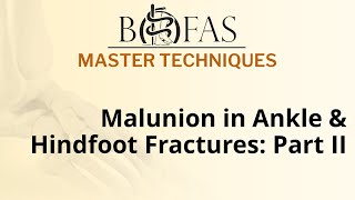 Malunion in Ankle amp Hindfoot Fractures Part II  BOFAS Master Techniques [upl. by Lindblad]