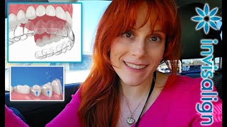 Things I learned after COMPLETING Invisalign  Tracking IPR Refinements amp Tips for Success [upl. by Marquis]