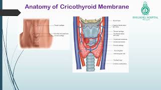 Cricothyroidotomy [upl. by Annwahs434]