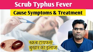 Scrub Typhus Cause Symptoms and Treatment Explained  स्क्रब टाइफस बुखार क्या है [upl. by Bancroft]