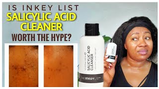 Dr V Approved INKEY LIST 2 SALICYLIC ACID Cleanser REVIEW [upl. by Durkee348]