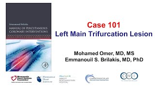 Case 101 PCI Manual  Left main trifurcation [upl. by Jabin49]