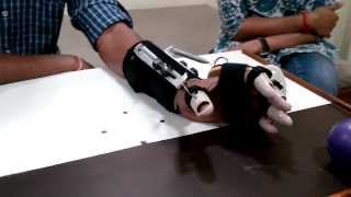 DHS Dynamic Hand Splint spastic hand splint [upl. by Bickart]