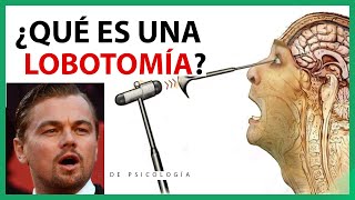 ¿Qué es una LOBOTOMIA Funciónes de la Lobotomía Cerebral [upl. by Shelburne373]