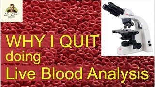 Why I QUIT Doing Live Blood Analysis [upl. by Arreyt234]