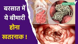 Amoebiasis Disease क्या है  Symptoms Reason और कैसे लें Precautions  Amoebasis Kya Hai Good Life [upl. by Giesecke]