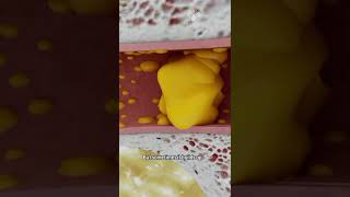 How to Remove Ear Wax Blockage the Right Way shorts facts  creativelearning3d [upl. by Aruol954]