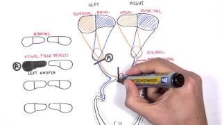 Visual Pathway and Lesions [upl. by Lishe780]