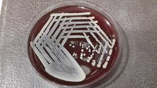 Betahaemolytic colonies of Staphylococcus aureus on blood agar Demonstration [upl. by Johnston]