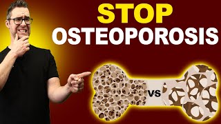 Top 7 Osteopenia amp Osteoporosis Treatments Symptoms amp Medications [upl. by Ettezzus641]