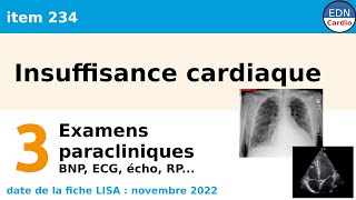 234  Insuffisance cardiaque  Partie 3  Examens paracliniques [upl. by Worthy]