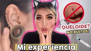 MIS PIERCINGS  EXPERIENCIA l QUELOIDES Como quitarlos Septum Medusa Nostril piercing oreja [upl. by Asiluy992]