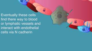 epithelialmesenchymal transition of metastasis [upl. by Adair]