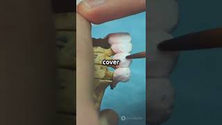 How to fix a chipped tooth [upl. by Haliehs]