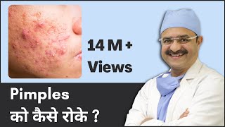 Pimples को कैसे रोके How to Prevent Pimples  2023  ClearSkin Pune  In HINDI [upl. by Luckin]