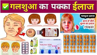 गलसुआ का पक्का ईलाज 😱  Mumps Treatment in Hindi  Parotitis Treatment  दवाईयों  Medicine  Pharma [upl. by Sklar]