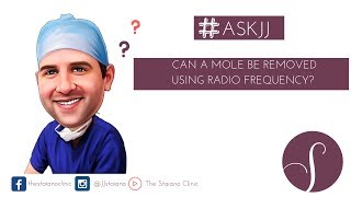 ASKJJ Can a mole be removed using radio frequency [upl. by O'Gowan]