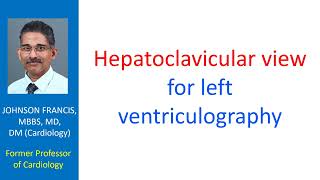 Hepatoclavicular view for left ventriculography [upl. by Lezah]