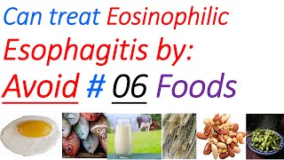 Eosinophilic esophagitis diet symptoms diagnosis treatment causes elimination diet [upl. by Cattan]