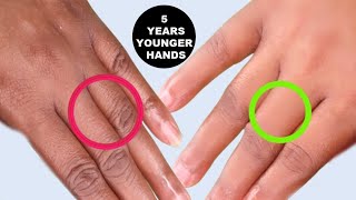 How To Make Your Hands Look 5 Years Younger Wrinkles Free Smooth Hands  Winter HandCare Routine [upl. by Odelinda317]