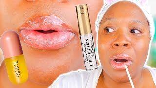 I Tried Every Popular LIP PLUMPER For 5 days 👄 [upl. by Nemad]