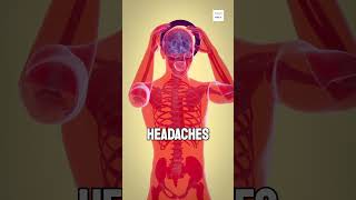 Why do we get headaches [upl. by Emery]