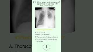 Radiology Buzz 17 radiologychannel007 [upl. by Ara14]